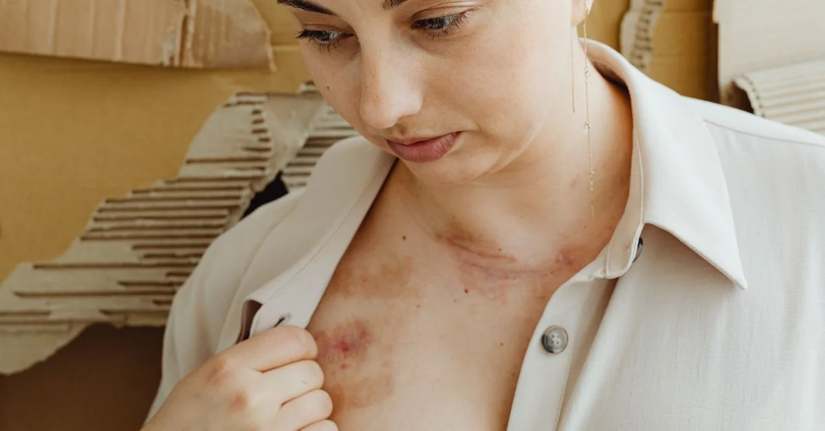 Gros plan d'une femme regardant les cicatrices sur sa poitrine, mettant en évidence les imperfections de la peau.