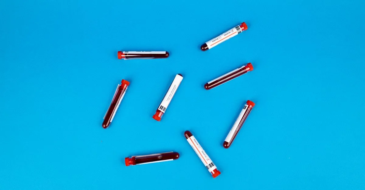 Plusieurs tubes d'échantillons de sang disposés sur un fond bleu vif.
