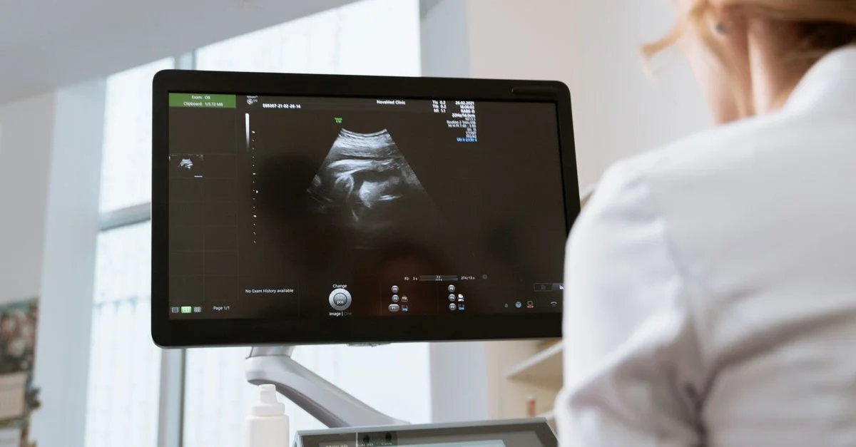 Professionnel de santé examinant un échographie sur un moniteur lors d'un examen médical.