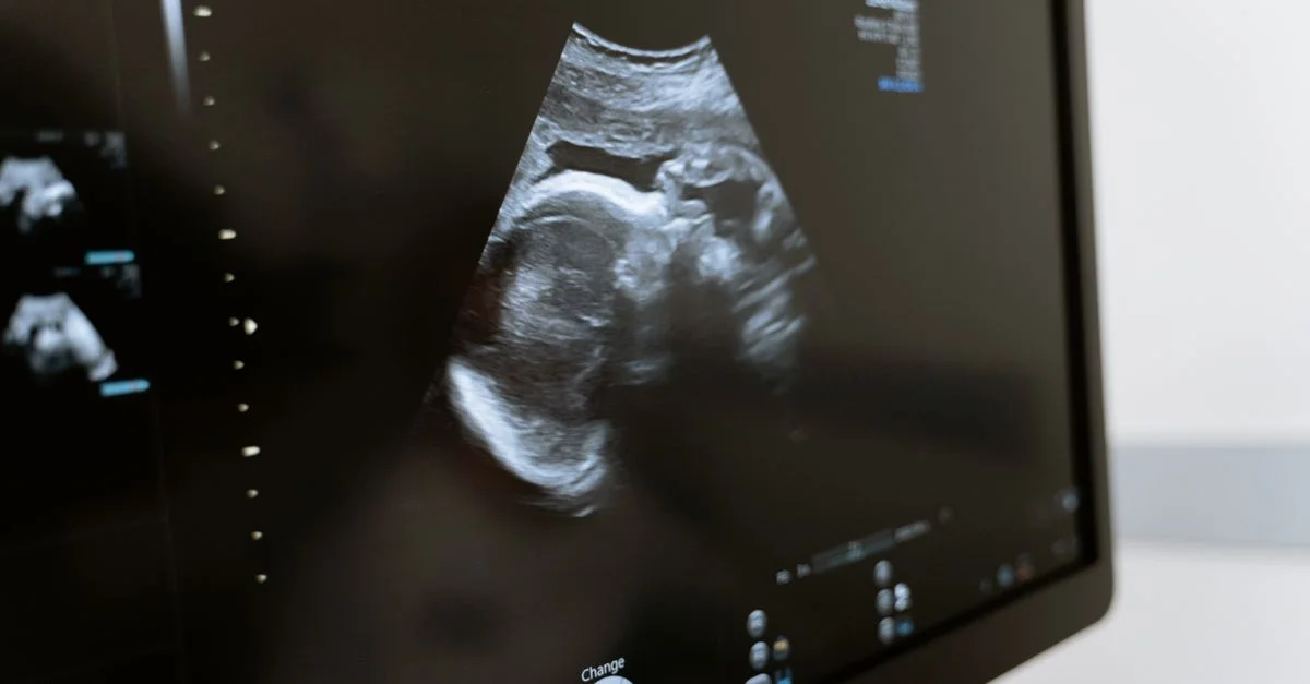 Gros plan d'une échographie montrant un fœtus sur un moniteur dans une clinique médicale.