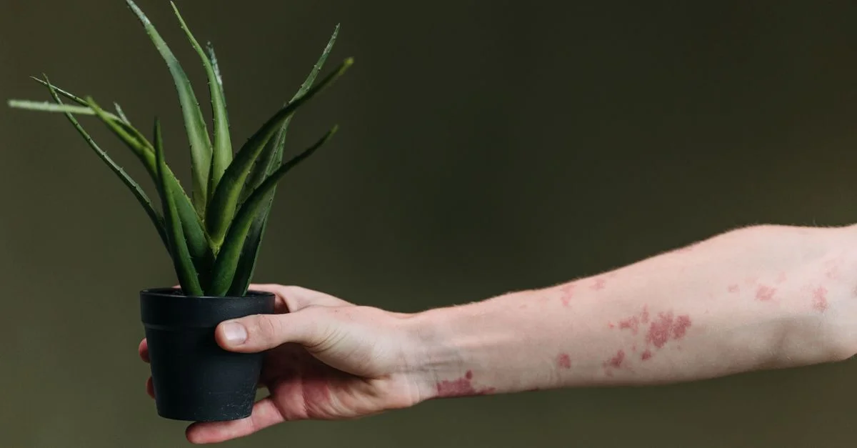 Gros plan d'une main avec une affection cutanée tenant une plante d'aloe vera en pot sur un fond vert.