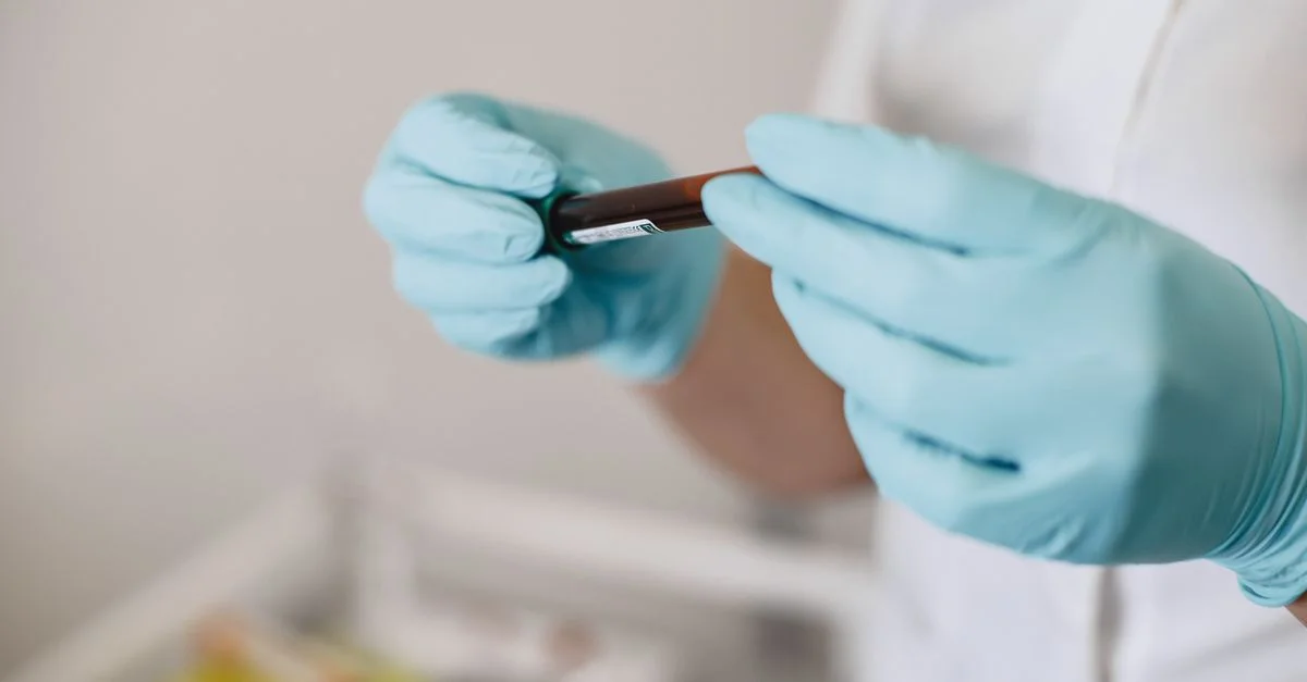 Gros plan d'un technicien de laboratoire tenant un flacon d'échantillon de sang dans un environnement médical.