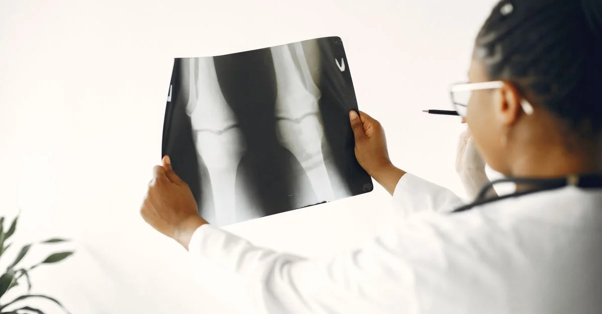 Un médecin examinant de près la radiographie du genou d'un patient pour évaluation orthopédique.