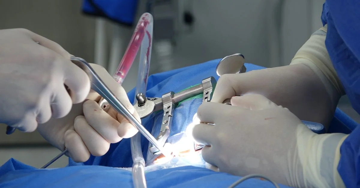 Chirurgiens dans une salle d'opération effectuant une chirurgie spinale avec des outils précis et un équipement stérile.