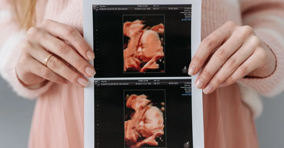 Gros plan sur une femme enceinte tenant un tirage d'échographie, symbolisant l'anticipation et les soins de maternité.