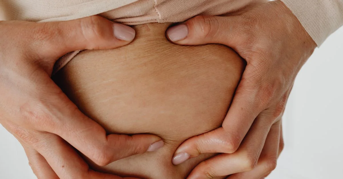 Un gros plan détaillé montrant les mains d'une femme tenant sa peau, en mettant l'accent sur les vergetures.