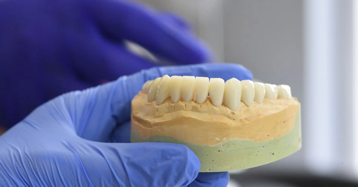 Gros plan sur un modèle dentaire tenu par des mains gantées dans un environnement de laboratoire.