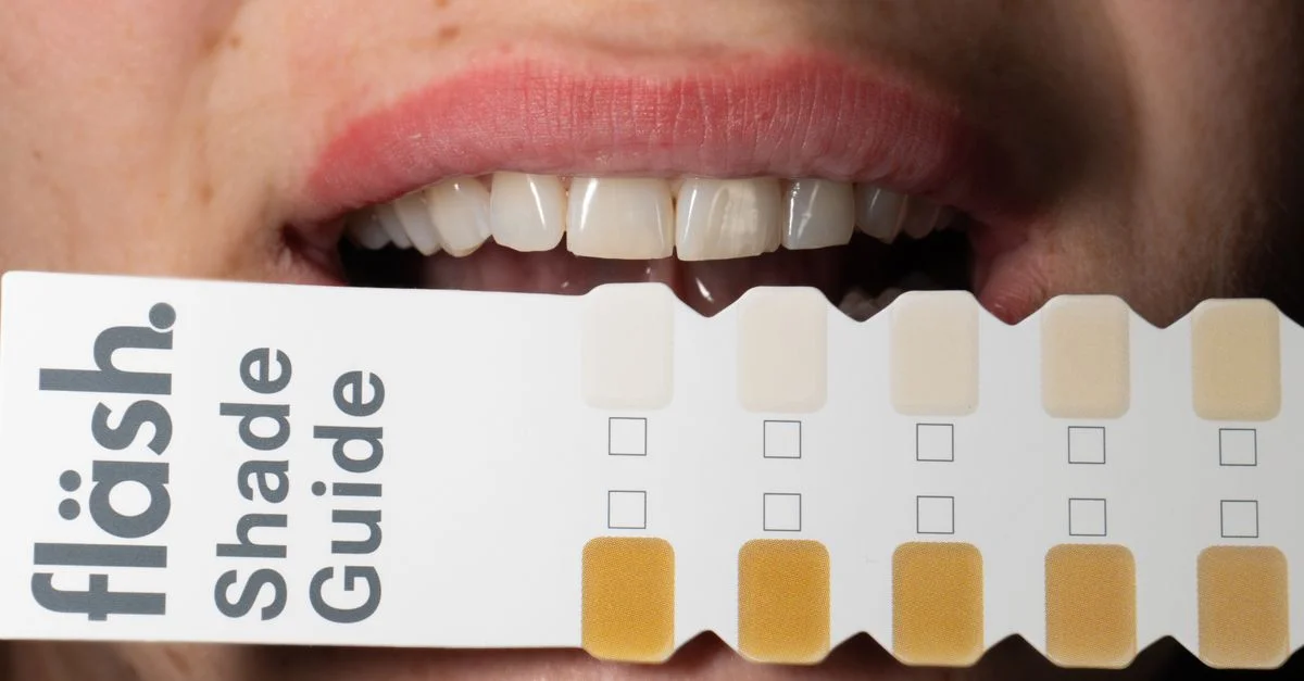 Adulte tenant un guide de teintes dentaires pour comparer les résultats de blanchiment des dents.