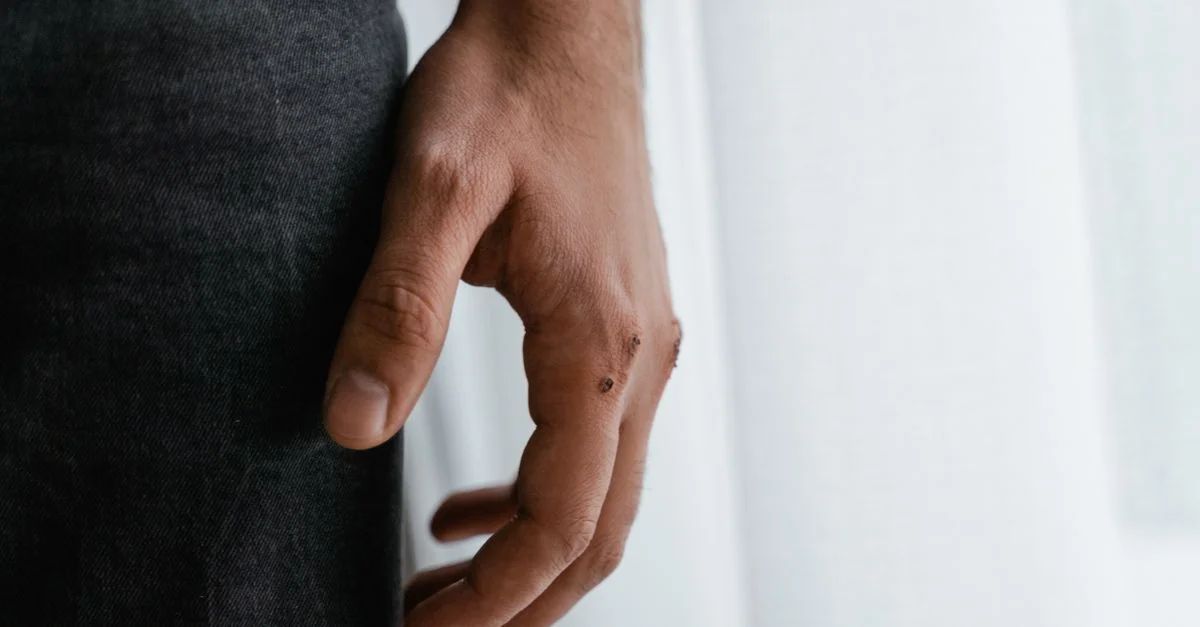 Un gros plan d'une main humaine avec une petite blessure sur un fond doux.