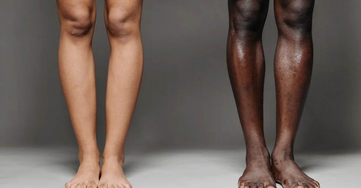 Image de deux paires de jambes nues diverses se tenant contre un fond gris, mettant en valeur la variété des teintes de peau.