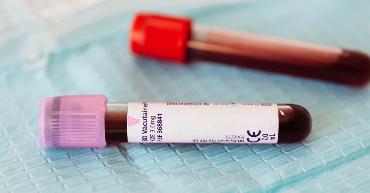 Vue en gros plan de flacons d'échantillons de sang sur une table médicale, idéal pour des thèmes en santé et en laboratoire.