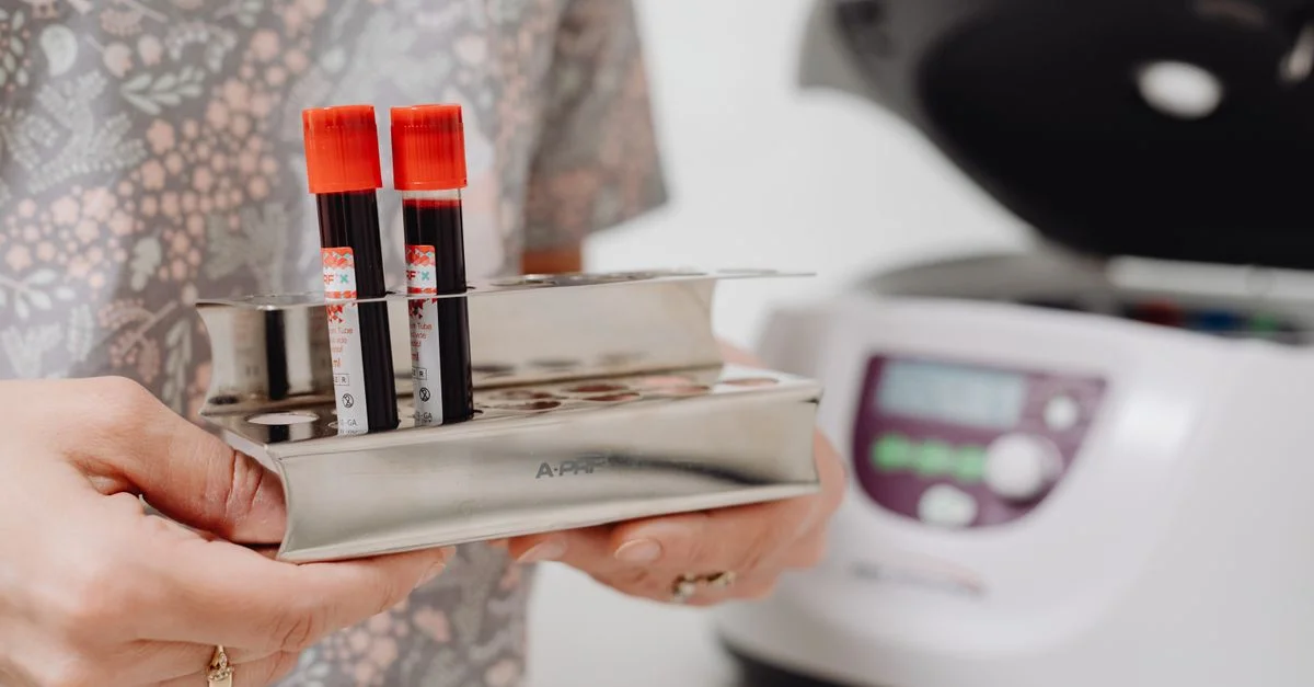 Gros plan sur des flacons de sang dans un laboratoire, prêts pour des tests.