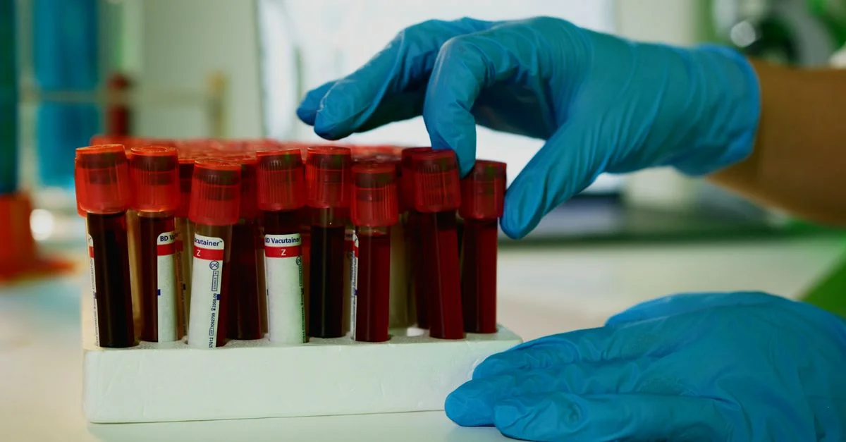 Un technicien de laboratoire manipule des flacons de sang dans un cadre de laboratoire, mettant en avant la recherche médicale.