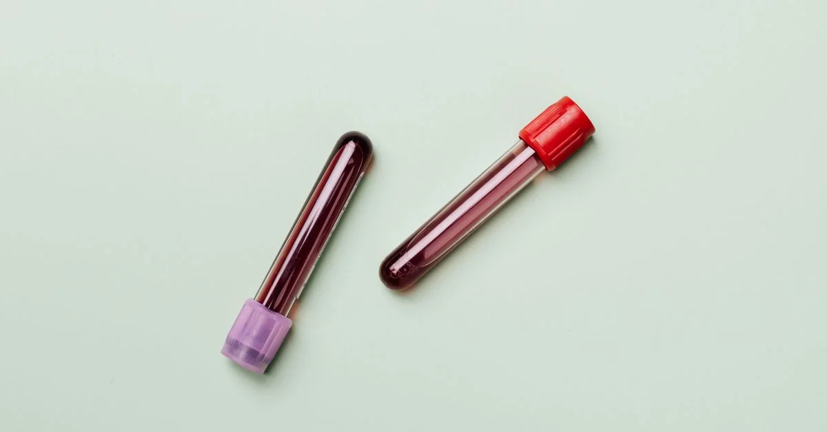 Échantillons de sang dans des tubes à essai sur un fond clair, idéal pour des thèmes médicaux et de laboratoire.